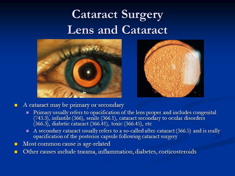 image-708661-CataractSurgeryLensandCataract.jpg